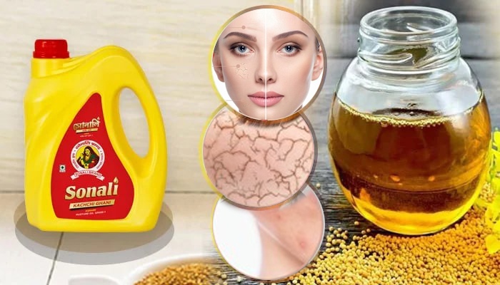 Mustard Oil For Skin Health